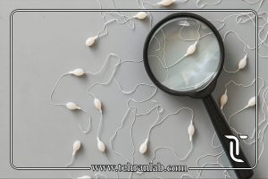 آزمایش اسپرم یا آزمایش هورمونی