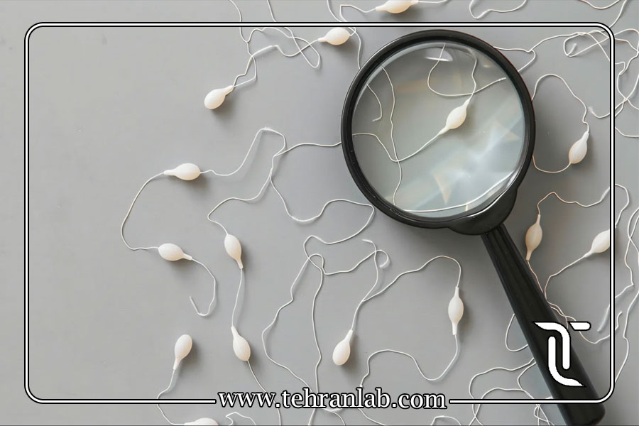 آزمایش اسپرم یا آزمایش هورمونی