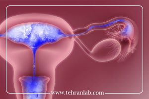 آزمایش ناباروری یا تصویربرداری رحمی