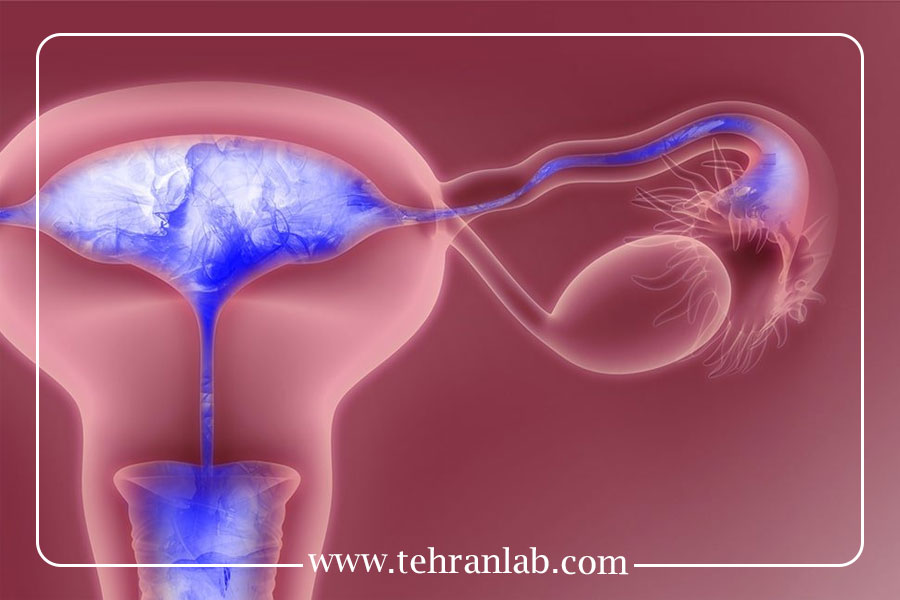 آزمایش ناباروری یا تصویربرداری رحمی