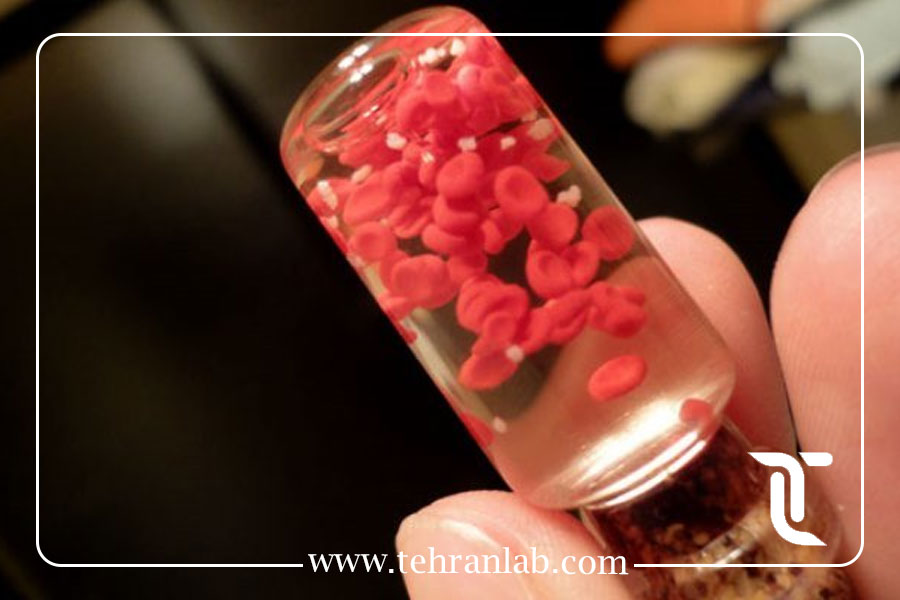 آزمایش هموفیلی