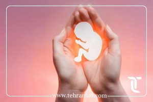 بررسی سقط مکرر