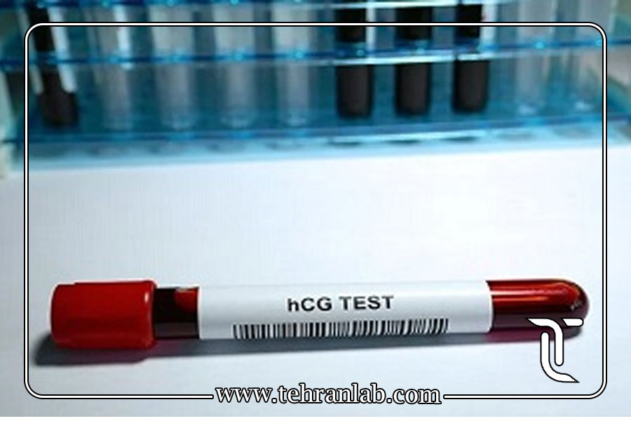 hCG پایین