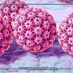 تشخیص اولیه زگیل تناسلی