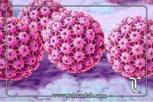 تشخیص اولیه زگیل تناسلی