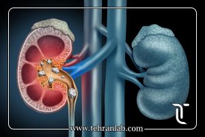 تومور مارکر بالا بدون سرطان
