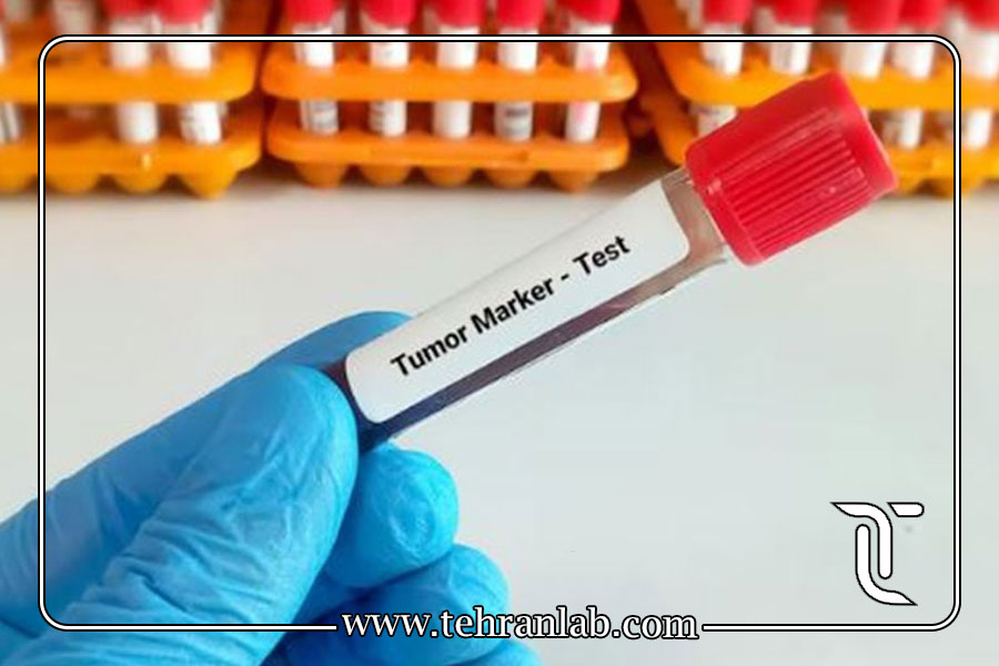 تکرار تومور مارکر