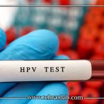 HPV مثبت