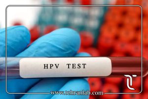 HPV مثبت