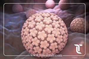 برگشت زگیل تناسلی