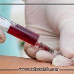 آمادگی قبل از نمونه‌گیری