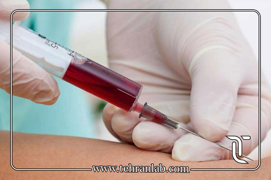 آمادگی قبل از نمونه‌گیری