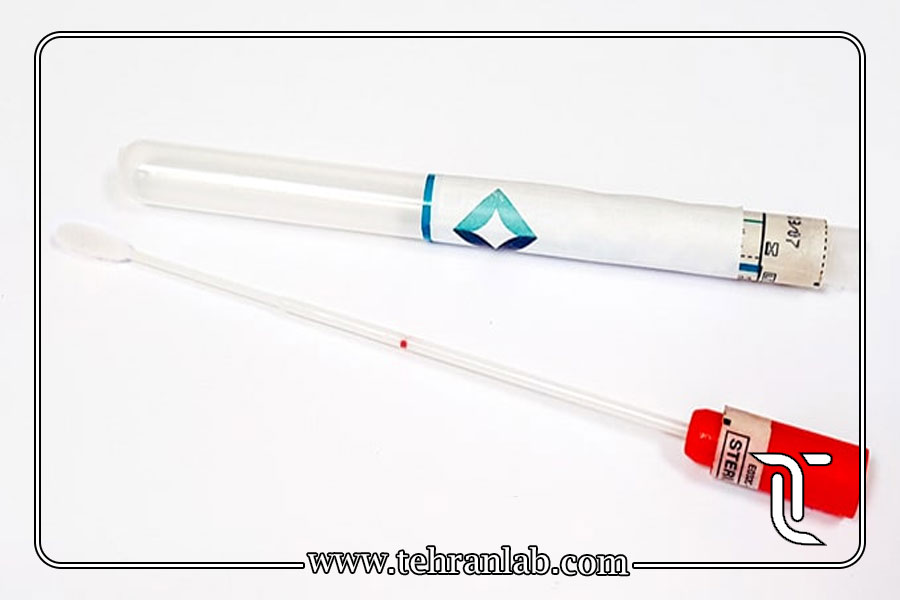 دقت آزمایش خانگی