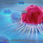 آزمایش تشخیص زودهنگام سرطان