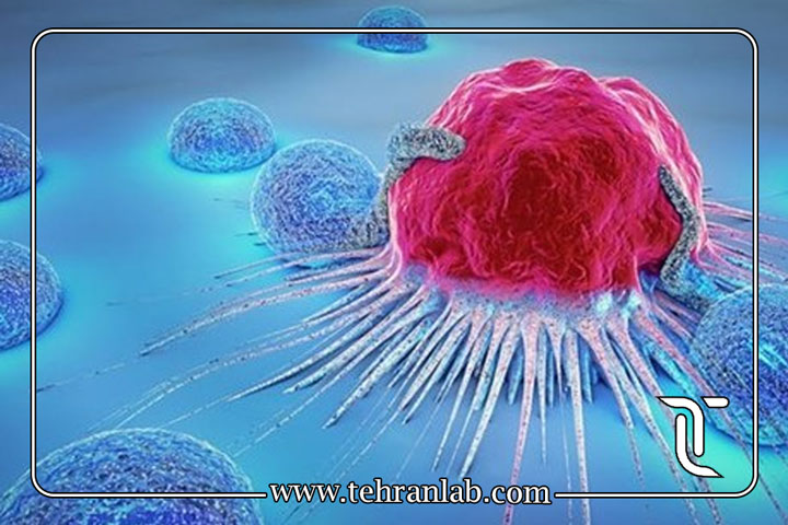 آزمایش تشخیص زودهنگام سرطان