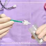 استرس و نتیجه پاپ اسمیر