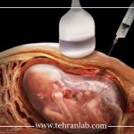 جواب پرخطر غربالگری بارداری