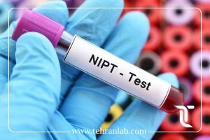 NIPT تعیین جنسیت