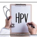 زمان انجام آزمایش HPV